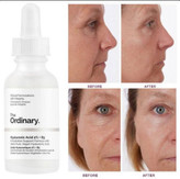 پک تقویت کننده پوست نیاسینامید و هیارونیک اسید حجم هر کدام 30ml